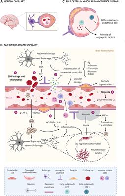 Endothelial Progenitor Cells and Vascular Alterations in Alzheimer’s Disease